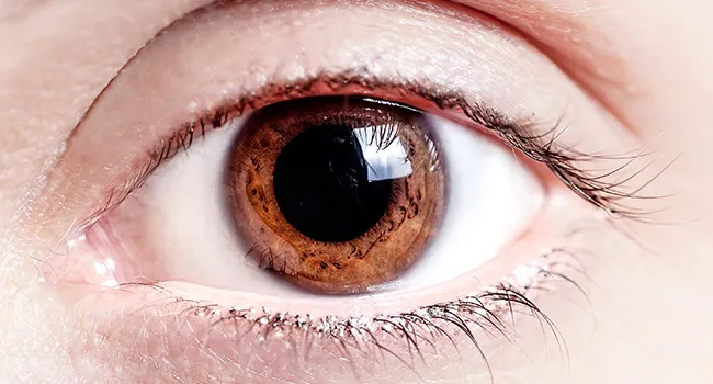 Dilated Pupils (Mydriasis) Causes, Symptoms and Treatment