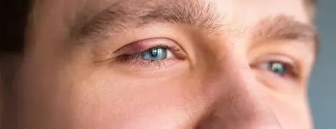 Eye Twitching: Causes, Symptoms and Treatment Options