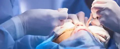 Oculoplasty Surgery - Things you should know about it