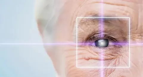  Cataract Surgery in Rajouri Garden
