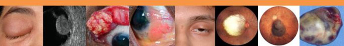 Centre for Sight
