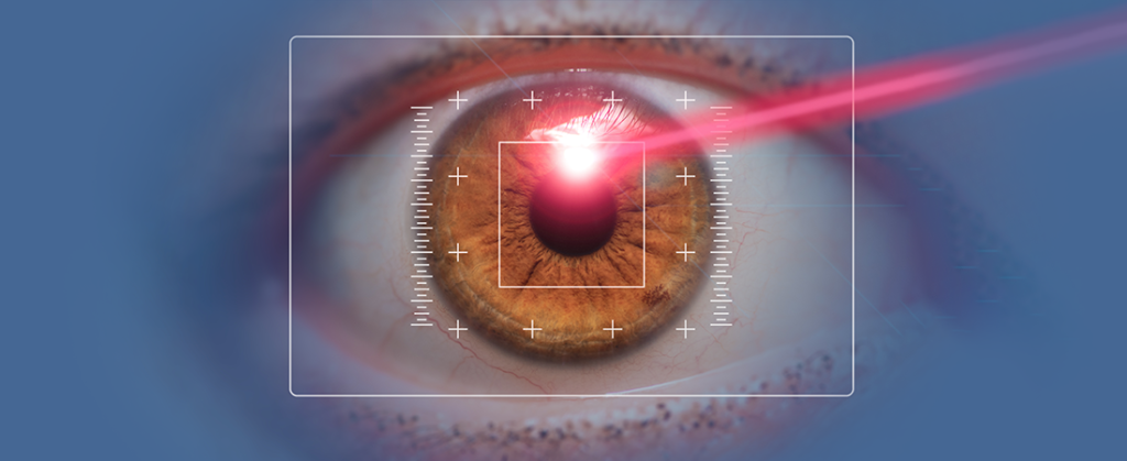 How to make Lasik eye surgery a smooth drive?