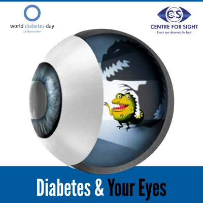 World Diabetes Day – Diabetes and Your Eyes