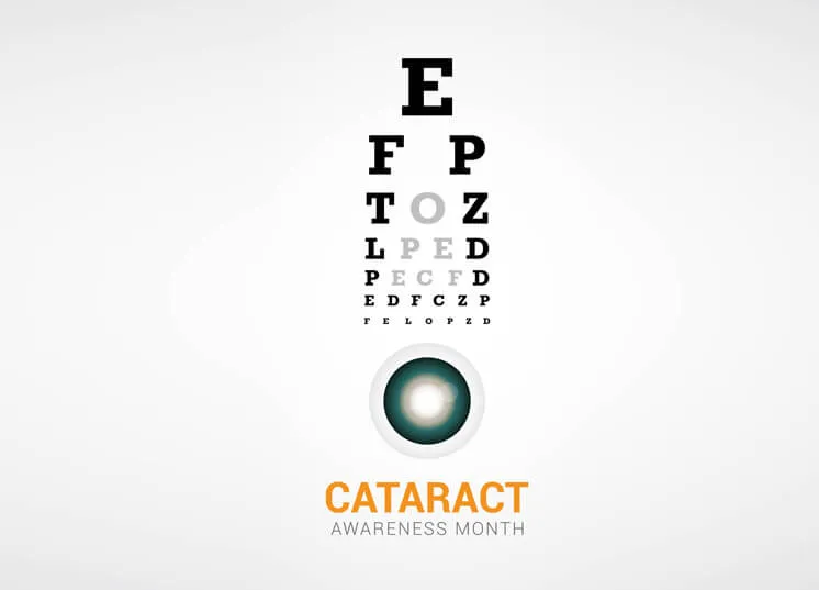 Five Things You Should Know About Robotic Cataract Surgery