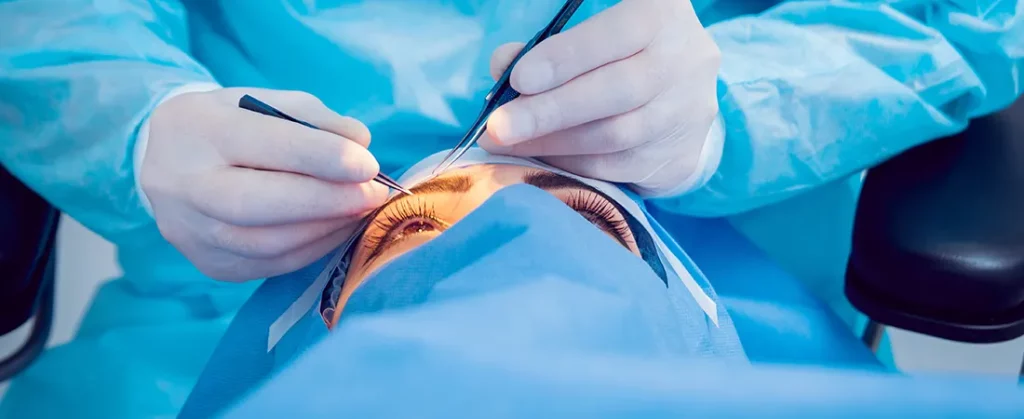 A Complete Guide on Laser Cataracts Surgery: Meaning, Benefits, & Treatment