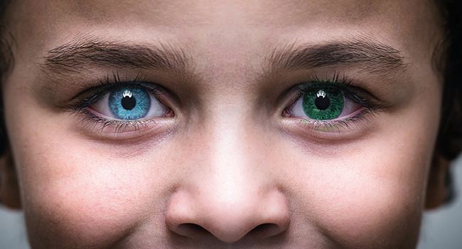 Heterochromia: The Mystery Behind Different-Colored Eyes
