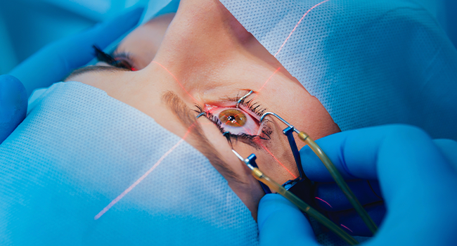 LASIK Surgery: Is it safe and should you get it?
