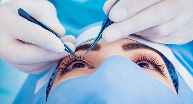 The Nuts & Bolts Of SMILE Laser Eye Surgery