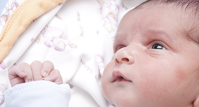 Retinopathy of Prematurity affects premature babies.