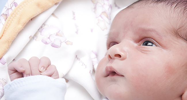 Retinopathy of Prematurity affects premature babies