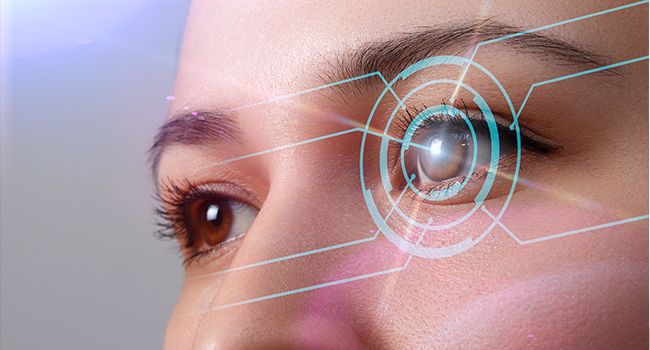 A comprehensive guide to SMILE Refractive Procedure A comprehensive guide to SMILE Refractive Procedure