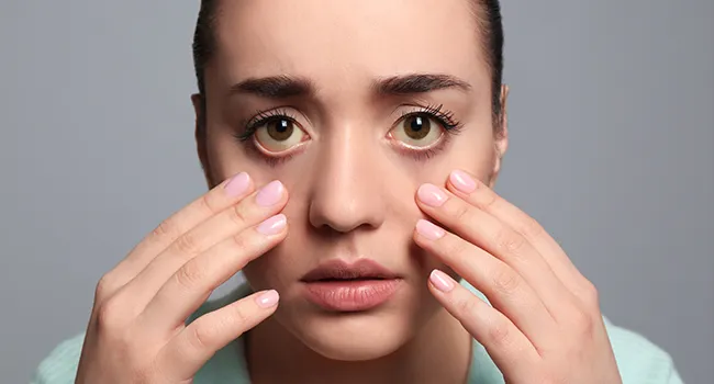 Common Eye Disorders and Diseases