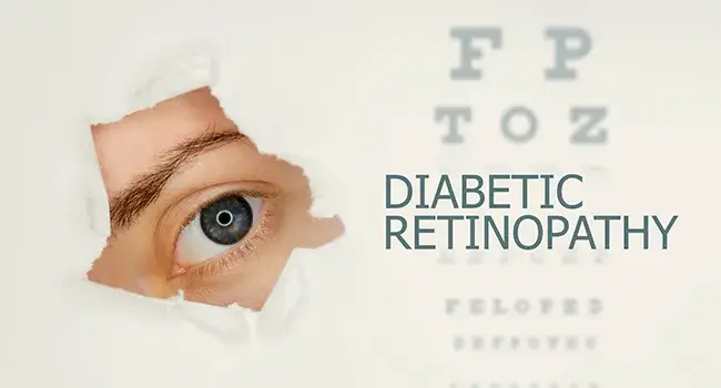 Diabetic Retinopathy: Learn All About It!