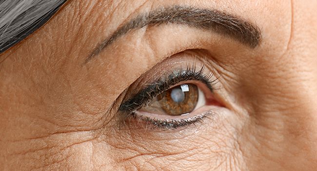 What to Do During a Glaucoma Attack?