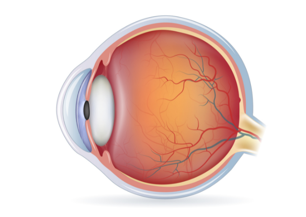 What are the significant causes of retinal tears?