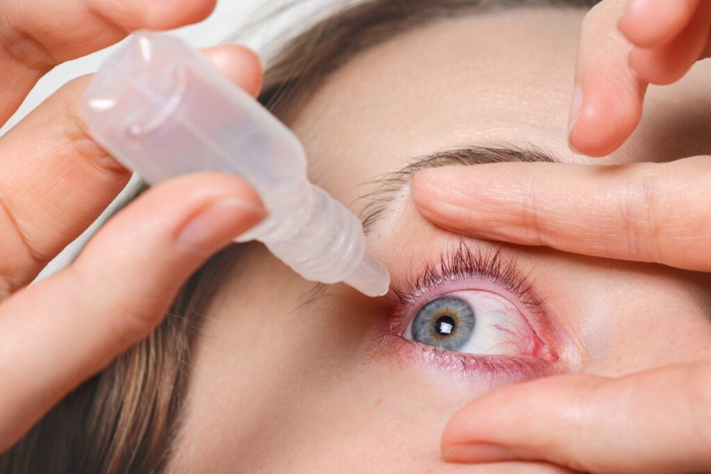 Do Dry Eyes Cause Vision Loss?