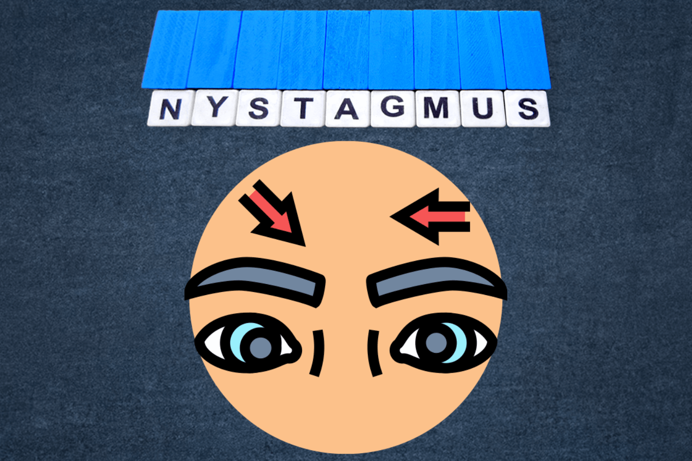 Nystagmus: Causes, Types, Symptoms and Treatments