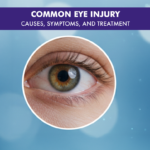 Common Eye Injury
