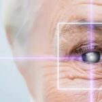 Cataract Surgery