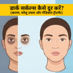 आंखों के नीचे डार्क सर्कल्स