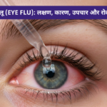 नेत्र फ्लू
